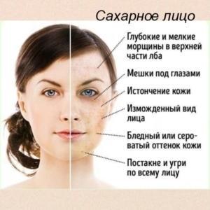 сахарное лицо