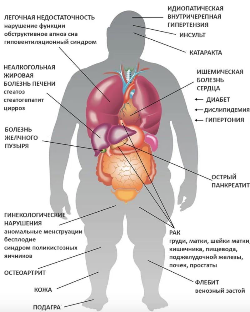 болезни и инсулинорезистентность